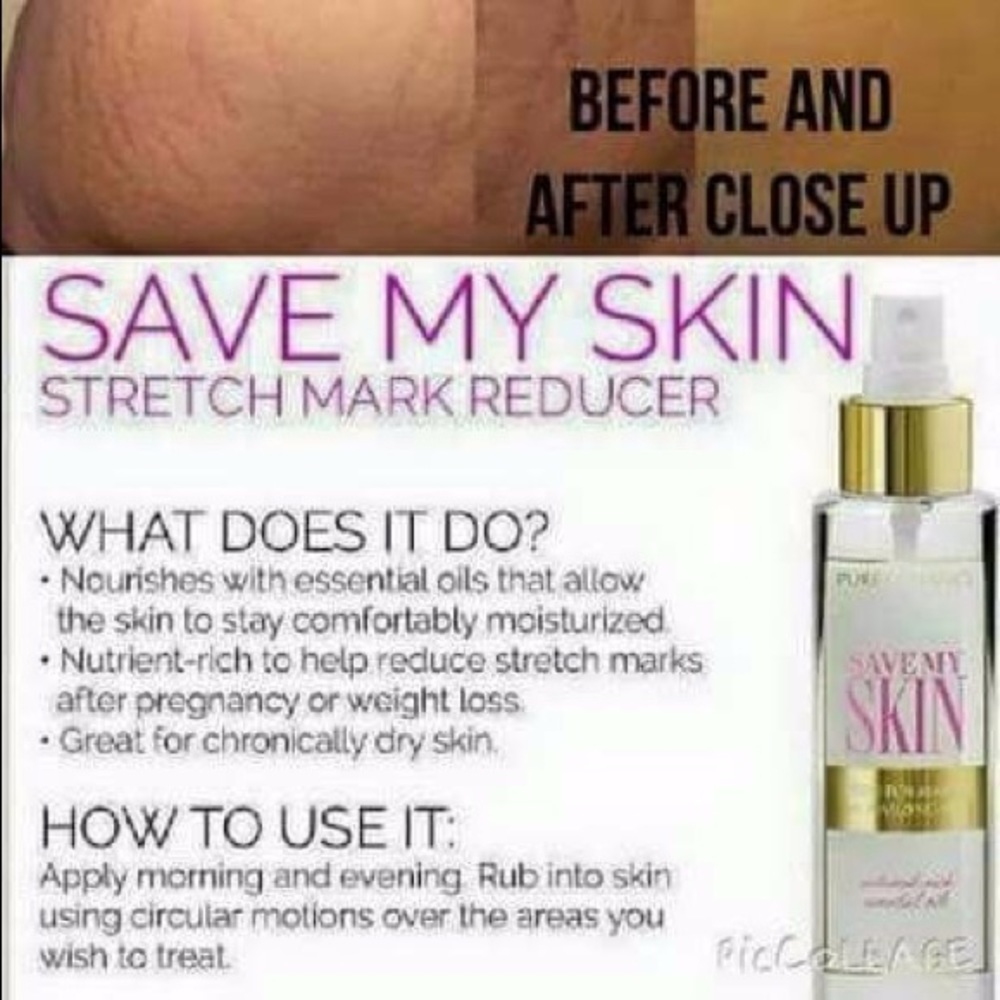 Pure romance save my skin